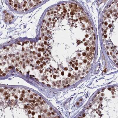 Immunohistochemistry-Paraffin: PPHLN1 Antibody [NBP1-89480]