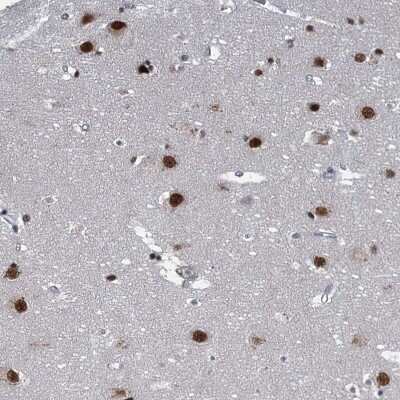 Immunohistochemistry-Paraffin: PPHLN1 Antibody [NBP2-38431]