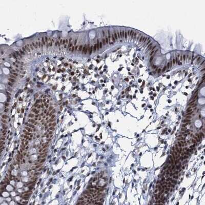 Immunohistochemistry-Paraffin: PPHLN1 Antibody [NBP2-38431]