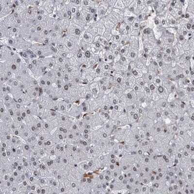 Immunohistochemistry-Paraffin: PPHLN1 Antibody [NBP2-38431]