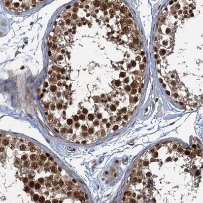 Immunohistochemistry-Paraffin: PPHLN1 Antibody [NBP2-38431]