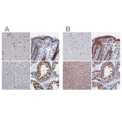 Immunohistochemistry-Paraffin: PPHLN1 Antibody [NBP2-38431]