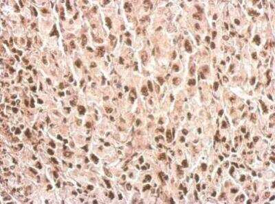 Immunohistochemistry-Paraffin: PPIH Antibody [NBP2-19899]