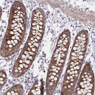 Immunohistochemistry-Paraffin: PPIH Antibody [NBP2-32416]
