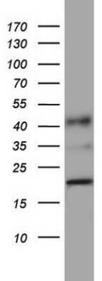 Western Blot: PPIH Antibody (OTI1C6)Azide and BSA Free [NBP2-73572]