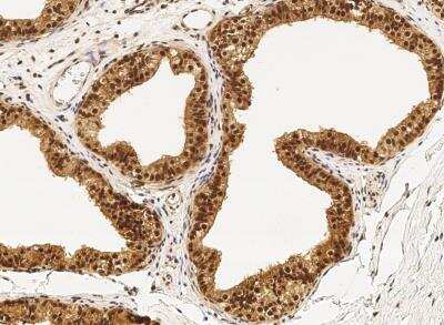 Immunohistochemistry-Paraffin: PPIL1 Antibody (003) [NBP2-90270]