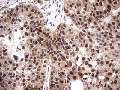 Immunohistochemistry: PPIL1 Antibody (OTI2D1) - Azide and BSA Free [NBP2-73573]