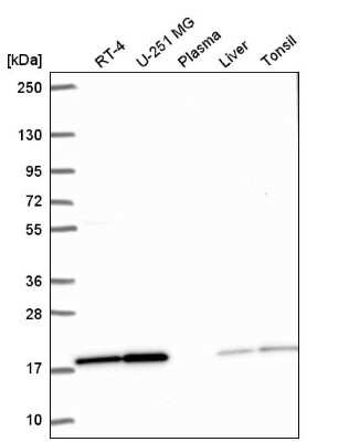 Western Blot: PPIL1 Antibody [NBP2-57062]