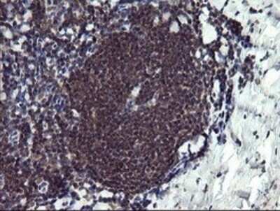 Immunohistochemistry: PPIL3 Antibody (OTI2E7) - Azide and BSA Free [NBP2-73574]