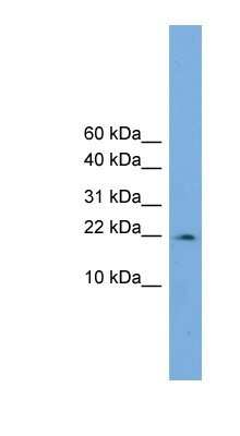 Western Blot: PPIL3 Antibody [NBP1-53189]