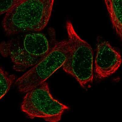 Immunocytochemistry/ Immunofluorescence: PPIL5 Antibody [NBP2-57485]