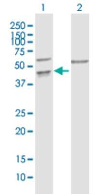 Western Blot: PPIL5 Antibody [H00122769-B02P]