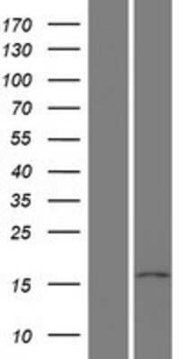 Western Blot: PPIL5 Overexpression Lysate [NBP2-04551]