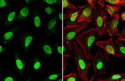 Immunocytochemistry/ Immunofluorescence: PPM1D Antibody [NBP3-12941]
