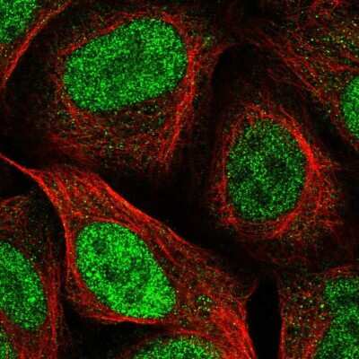 Immunocytochemistry/ Immunofluorescence: PPM1H Antibody [NBP2-38859]