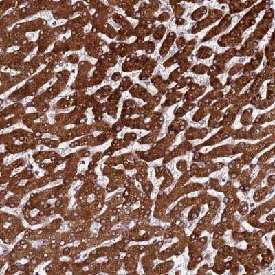 Immunohistochemistry: PPM1H Antibody [NBP2-38526]