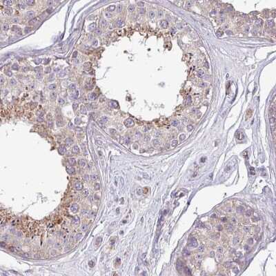 Immunohistochemistry-Paraffin: PPM1J Antibody [NBP2-13797]