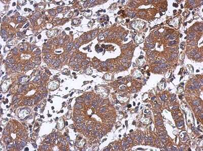 Immunohistochemistry-Paraffin: PPM1J Antibody [NBP2-19902]