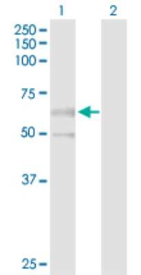 Western Blot: PPM1J Antibody [H00333926-D01P]