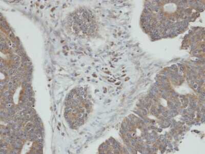 Immunohistochemistry-Paraffin: PPM1K Antibody [NBP1-31444]