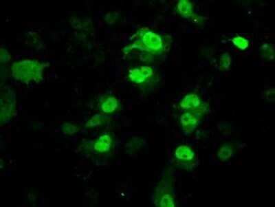 Immunocytochemistry/ Immunofluorescence: PPME1 Antibody (OTI7F12) - Azide and BSA Free [NBP2-73583]