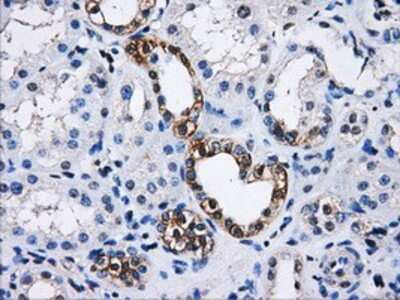 Immunohistochemistry: PPME1 Antibody (OTI7F12) - Azide and BSA Free [NBP2-73583]