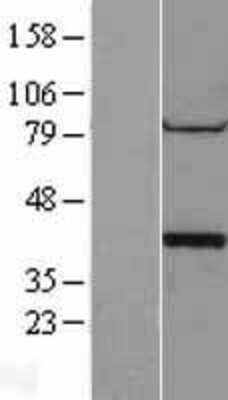 Western Blot: PP1 alpha/PPP1A Overexpression Lysate [NBL1-14670]