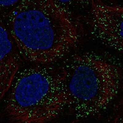 Immunocytochemistry/ Immunofluorescence: PPP1R11 Antibody [NBP2-55752]