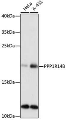 Western Blot: PPP1R14B AntibodyAzide and BSA Free [NBP2-93749]