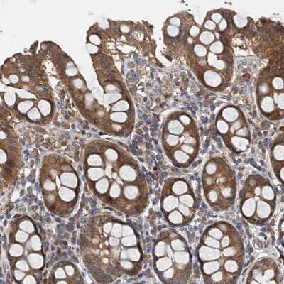 Immunohistochemistry-Paraffin: PPP1R14D/GBPI-1 Antibody [NBP1-85484]