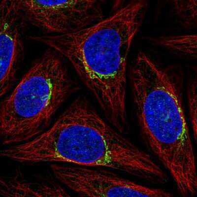 Immunocytochemistry/ Immunofluorescence: PPP1R15B Antibody [NBP2-58589]