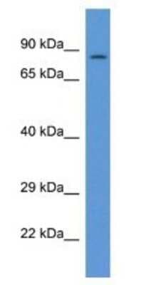 Western Blot: PPP1R15B Antibody [NBP1-74269]