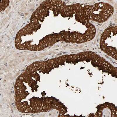 Immunohistochemistry-Paraffin: PPP1R16A Antibody [NBP1-82750]