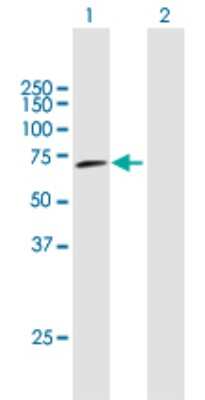 Western Blot: PPP1R16A Antibody [H00084988-B01P]