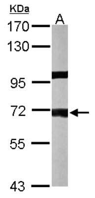 Western Blot: PPP1R16A Antibody [NBP1-32480]