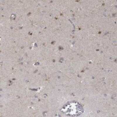 Immunohistochemistry-Paraffin: PPP1R16B Antibody [NBP3-17296]