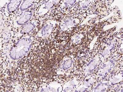 Immunohistochemistry-Paraffin: PPP1R18 Antibody [NBP2-97370]