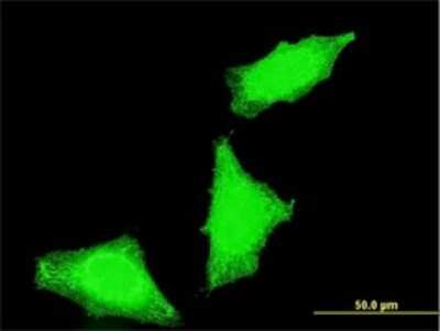 Immunocytochemistry/ Immunofluorescence: PPP1R2P3 Antibody (1H2) [H00153743-M02]