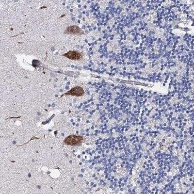 Immunohistochemistry-Paraffin: PPP1R32 Antibody [NBP1-93873]