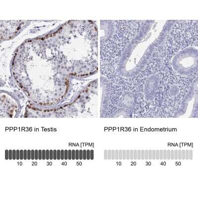 Immunohistochemistry-Paraffin: PPP1R36 Antibody [NBP2-62718]