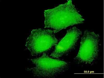 Immunocytochemistry/ Immunofluorescence: PPP1R3B Antibody [H00079660-B01P]