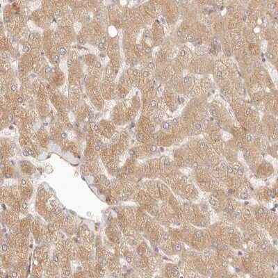 Immunohistochemistry-Paraffin: PPP1R3B Antibody [NBP1-82243]