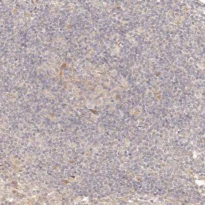 Immunohistochemistry-Paraffin: PPP1R3B Antibody [NBP1-82243]