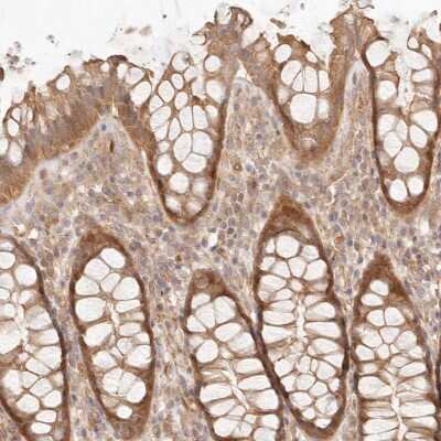 Immunohistochemistry-Paraffin: PPP1R3B Antibody [NBP1-82243]