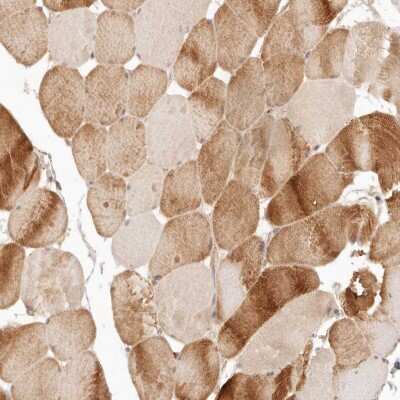 Immunohistochemistry-Paraffin: PPP1R3B Antibody [NBP1-82243]