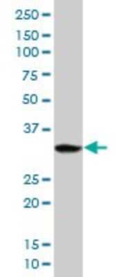 Western Blot: PPP1R3B Antibody [H00079660-B01P]