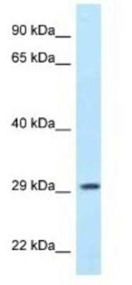 Western Blot: PPP1R3B Antibody [NBP1-79917]