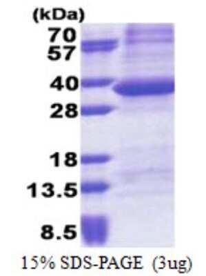 SDS-PAGE: Recombinant Human PPP1R3B His Protein [NBP2-23381]
