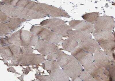 Immunohistochemistry-Paraffin: PPP1R3C Antibody [NBP1-87236]