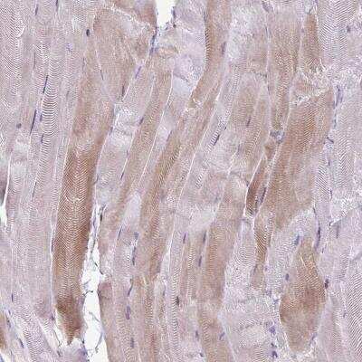 Immunohistochemistry-Paraffin: PPP1R3E Antibody [NBP2-32351]